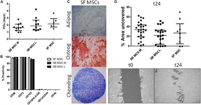 Gene Expression Signatures of Synovial Fluid Multipotent Stromal Cells in Advanced Knee Osteoarthritis and Following Knee Joint Distraction